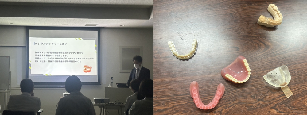 デジタルデンチャーに関するセミナー風景